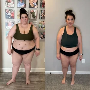 Who Benefits Most from Single-Receptor GLP-1 Therapy with Semanize® Semaglutide?